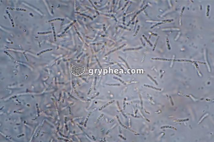 Mycobactéries x400 - gryphea.com